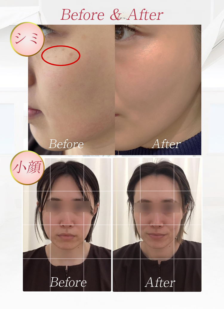 Before&After